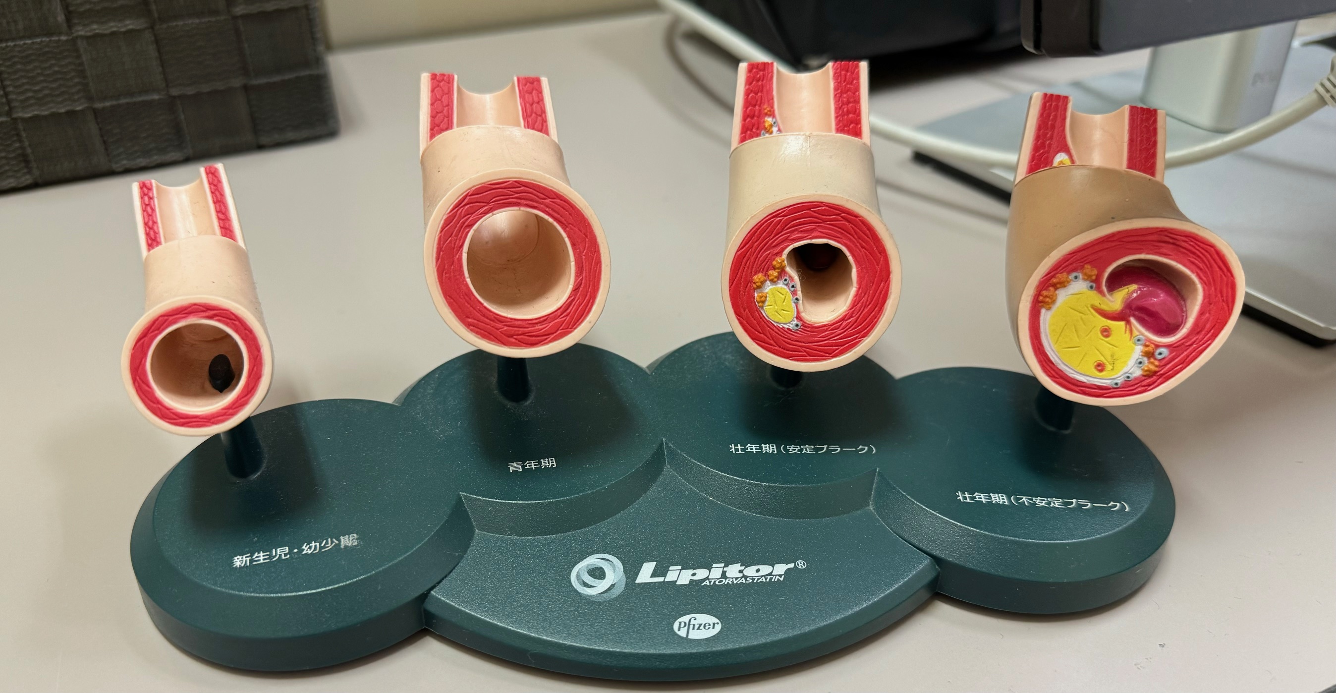 「人間ドック」2024年1月15日